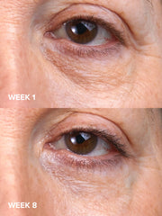 C5 Super Boost Eye Cream
